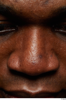 HD Face Skin Clayton Bradford face nose skin pores skin…
